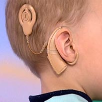 Кохлеарная имплантация Днепр