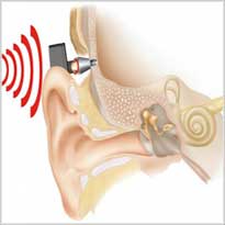 Исследование коротколатентных слуховых вызванных потенциалов
