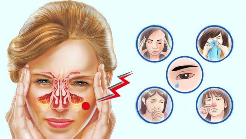 симптомы ринита