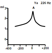 график импедансометрии